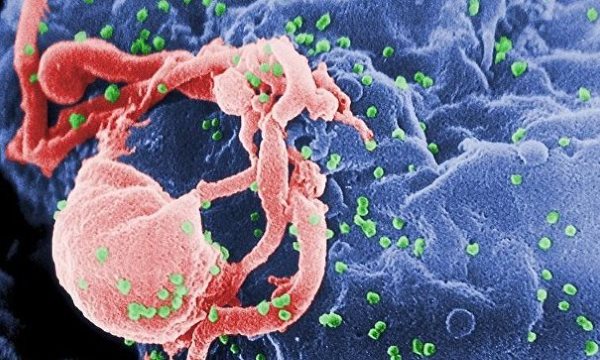 Scientists destroy HIV